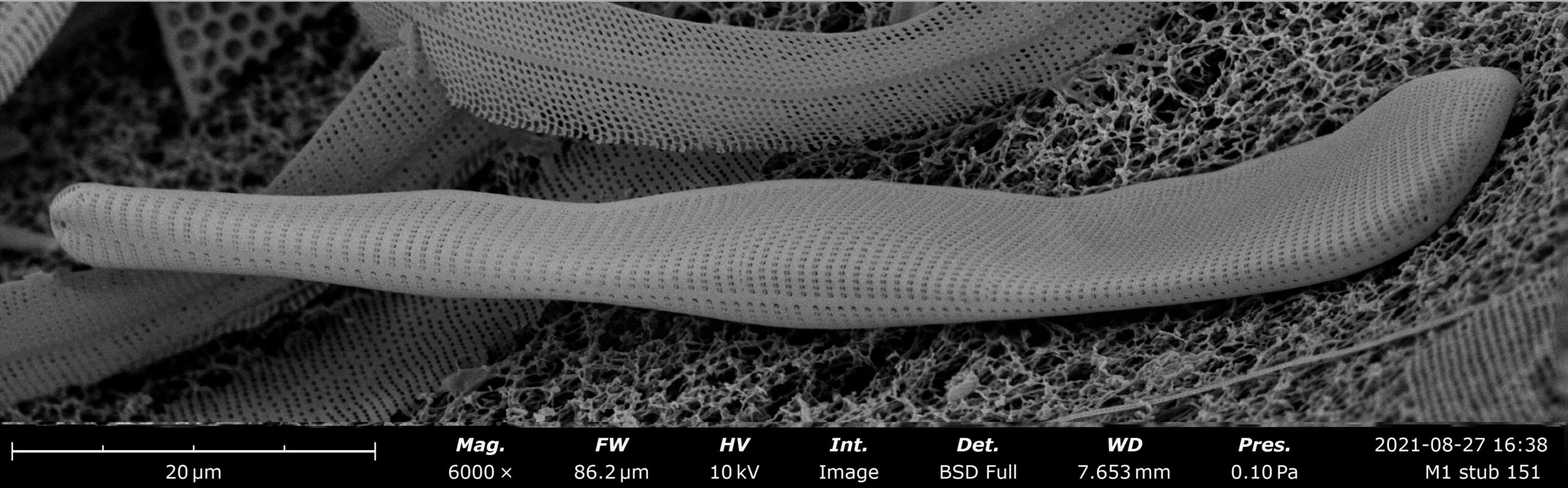 The new species of diatom, Licmophora complanata, was named for its flattened cell wall. According to Lobban, the diatom was found in a sample of algae from Majuro Atoll that he collected in 1990.